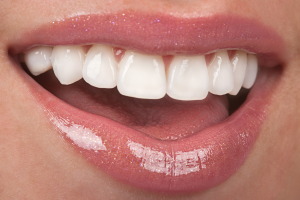 'woman smiling after receiving cosmetic treatment'